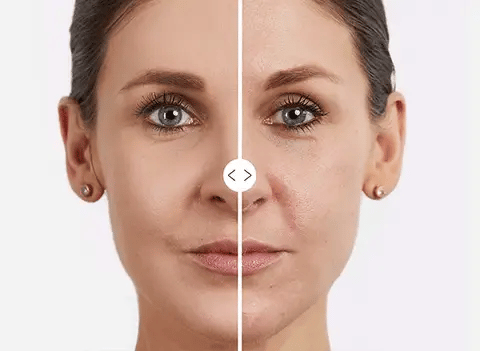 ROLL-ON  Efecto Fresh-Eyes