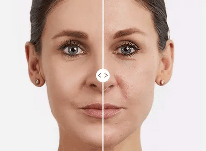 ROLL-ON  Efecto Fresh-Eyes