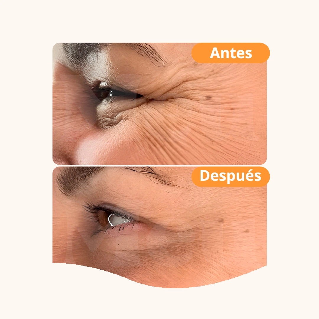 ROLL-ON  Efecto Fresh-Eyes